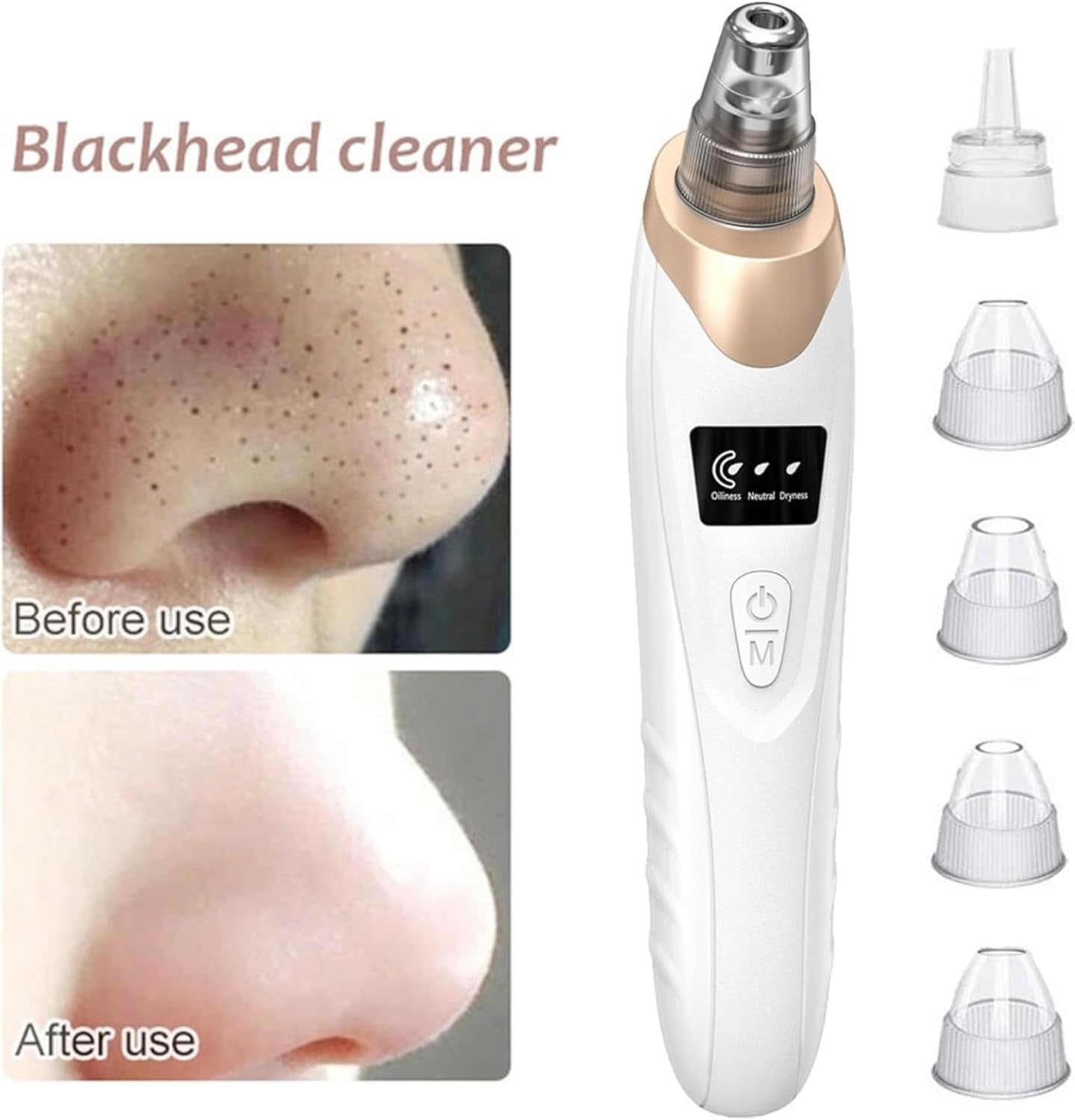 2024 Newest Blackhead Remover Pore Vacuum,Facial Pore Cleaner-5 Suction Power,5 Probes,Usb Rechargeable Blackhead Vacuum Kit Electric Acne Extractor Tool for Women